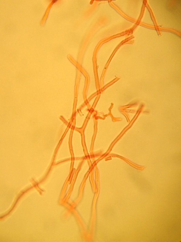 Byssomerulius corium? (Byssomerulius corium)